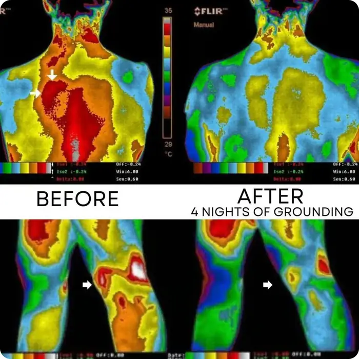 Thermal imaging before and after 4 nights of grounding on the Terra sheet